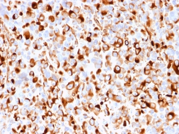 NGF Receptor Antibody / p75NTR / CD271