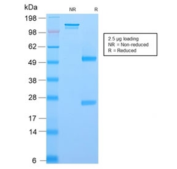 NGF Receptor Antibody / p75NTR / CD271