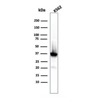 Nucleophosmin Antibody / NPM1