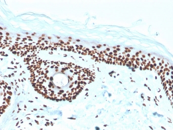 Nucleophosmin Antibody / NPM1