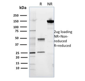 ROR2 Antibody