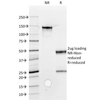 ROR2 Antibody