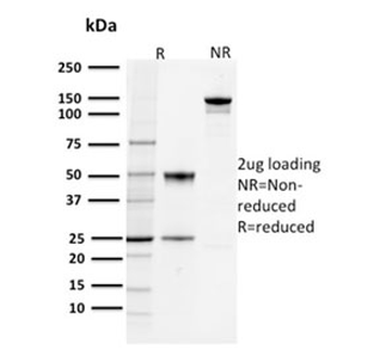 PD-L1 Antibody / B7-H1 / CD274