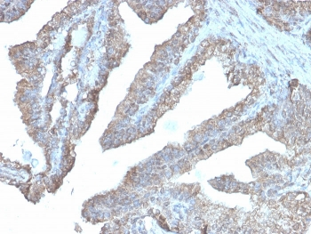 Ornithine Decarboxylase Antibody / ODC1
