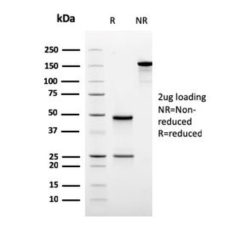 Ornithine Decarboxylase Antibody / ODC1