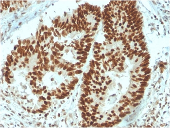 MSH6 Antibody