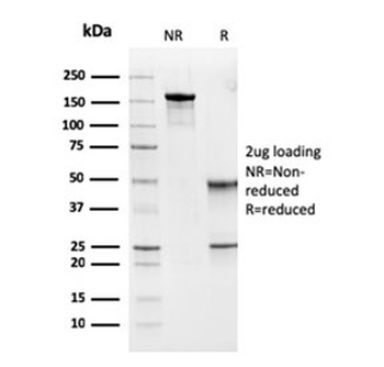 MSH6 Antibody