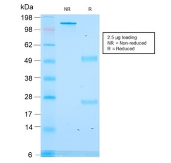 Recombinant CLIP Antibody / ACTH