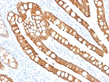 Cytokeratin 20 Antibody / CK20