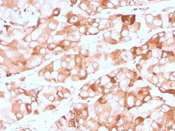 Prolactin Receptor Antibody / PRLR