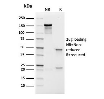 Prolactin Receptor Antibody / PRLR
