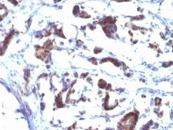 ZFYVE28 Antibody