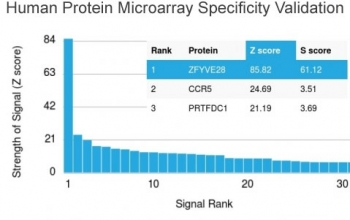 ZFYVE28 Antibody