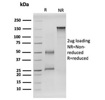 RET Antibody
