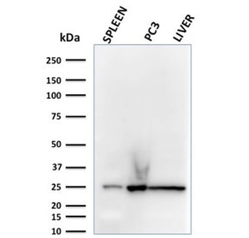 C1QA Antibody / Complement C1q A-Chain