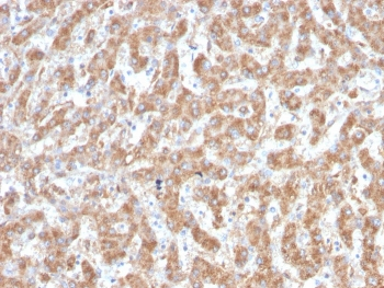 C1QA Antibody / Complement C1q A-Chain