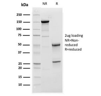 C1QA Antibody / Complement C1q A-Chain
