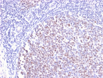 Recombinant Bcl6 Antibody