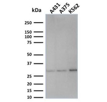 Replication Protein A2 Antibody / RPA32