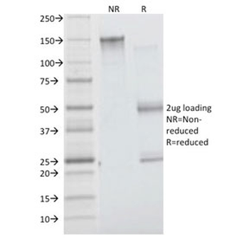 Insulin Receptor alpha Antibody
