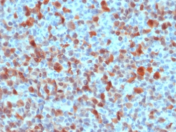 S100B Antibody