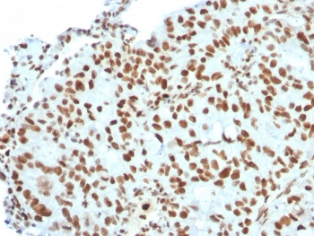 BMI1 Antibody