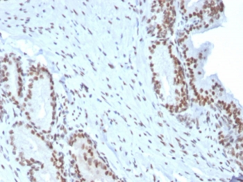 BMI1 Antibody