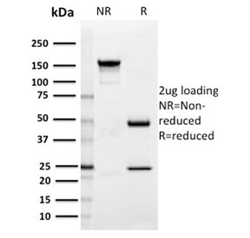 SIGLEC1 Antibody / CD169 / Sialoadhesin