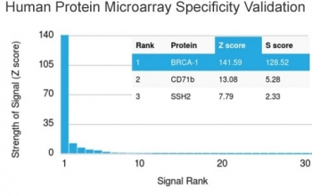 BRCA1 Antibody