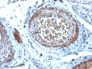 StAR Antibody / Steroidogenic acute regulatory protein