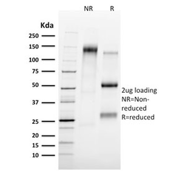 TAL1 Antibody / T-cell acute lymphocytic leukemia protein 1