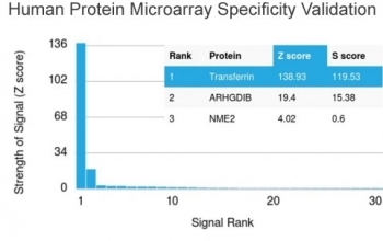 Transferrin Antibody