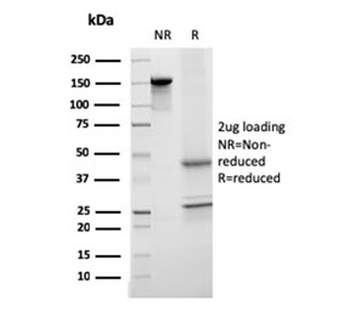 Transferrin Antibody