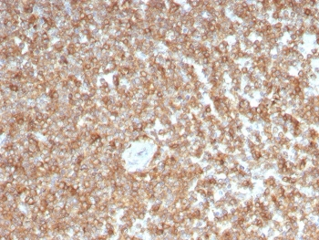 Granulocyte-Macrophage CSF Antibody / CSF2