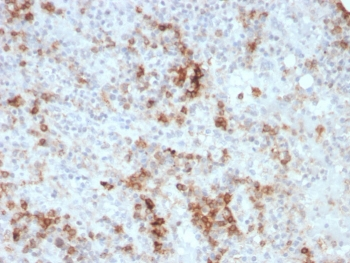 Granulocyte-Macrophage CSF Antibody / CSF2