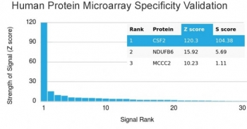 Granulocyte-Macrophage CSF Antibody / CSF2