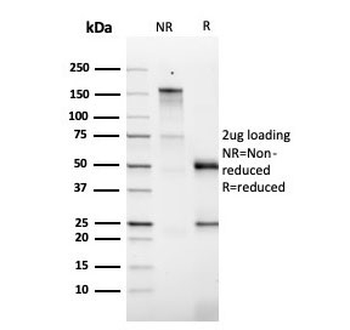Granulocyte-Macrophage CSF Antibody / CSF2