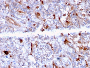 C1QA Antibody / Complement C1q A-Chain