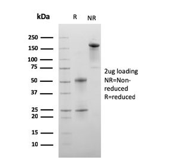 C1QA Antibody / Complement C1q A-Chain