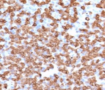 CD11b Antibody / MAC-1