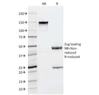 TPSAB1 Antibody / Mast Cell Tryptase