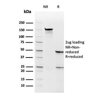 Thymidylate Synthase Antibody