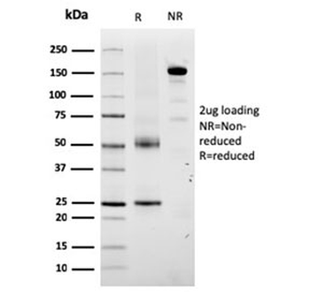 TRP1 / Tyrosinase-Related Protein-1 Antibody