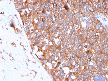 Uroplakin 1B Antibody / UPK1B