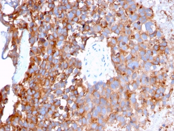 Uroplakin 1B Antibody / UPK1B