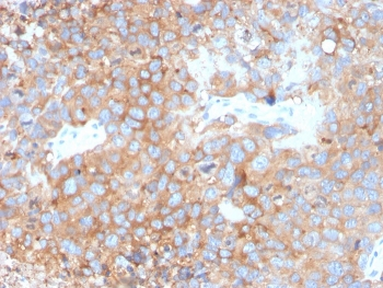 Uroplakin 1B Antibody / UPK1B