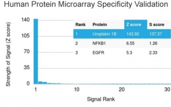 Uroplakin 1B Antibody / UPK1B