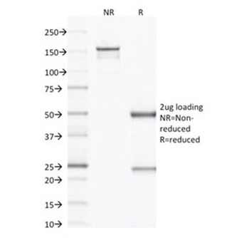 VEGF Antibody