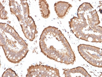 Villin Antibody Cocktail