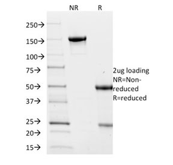 Villin Antibody